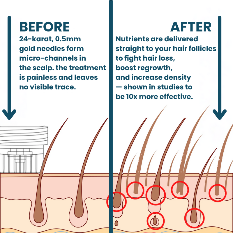 Hair loss treatment