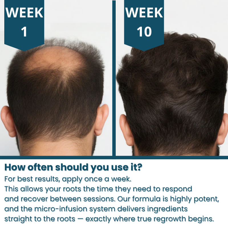 Hair loss treatment