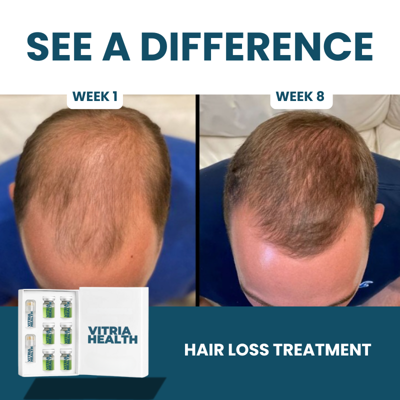 Hair loss treatment