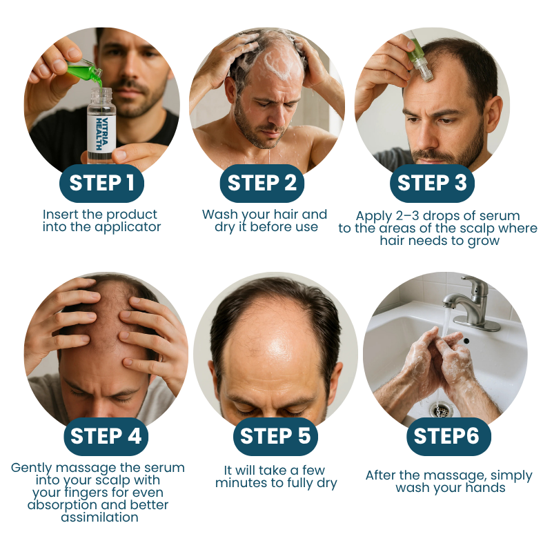 Hair loss treatment
