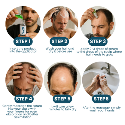 Hair loss treatment